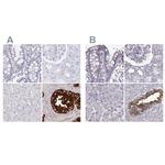 SEMG2 Antibody in Immunohistochemistry (IHC)