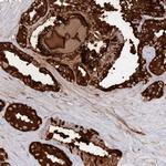 SEMG2 Antibody in Immunohistochemistry (IHC)