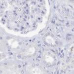 SEMG2 Antibody in Immunohistochemistry (IHC)