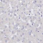 SEMG2 Antibody in Immunohistochemistry (IHC)