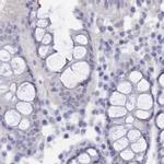 SEMG2 Antibody in Immunohistochemistry (IHC)