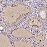 SLC26A4 Antibody in Immunohistochemistry (IHC)