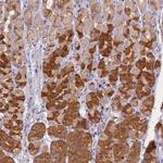 SLC26A4 Antibody in Immunohistochemistry (IHC)