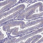 SLC26A4 Antibody in Immunohistochemistry (IHC)