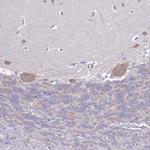 RC3H2 Antibody in Immunohistochemistry (Paraffin) (IHC (P))