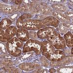 RC3H2 Antibody in Immunohistochemistry (Paraffin) (IHC (P))