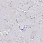 RC3H2 Antibody in Immunohistochemistry (Paraffin) (IHC (P))