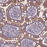 RC3H2 Antibody in Immunohistochemistry (Paraffin) (IHC (P))