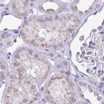 CHMP5 Antibody in Immunohistochemistry (IHC)