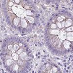 CHMP5 Antibody in Immunohistochemistry (IHC)