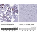 NUSAP1 Antibody in Immunohistochemistry (IHC)