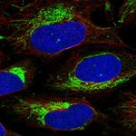 CHCHD3 Antibody in Immunocytochemistry (ICC/IF)