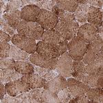 CHCHD3 Antibody in Immunohistochemistry (IHC)