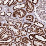 CHCHD3 Antibody in Immunohistochemistry (IHC)