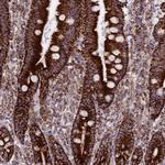 CHCHD3 Antibody in Immunohistochemistry (IHC)