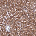 CHCHD3 Antibody in Immunohistochemistry (IHC)