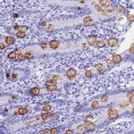 OR10J3 Antibody in Immunohistochemistry (Paraffin) (IHC (P))