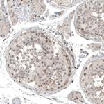 PAPD5 Antibody in Immunohistochemistry (IHC)