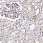 PAPD5 Antibody in Immunohistochemistry (IHC)