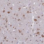 NALP12 Antibody in Immunohistochemistry (Paraffin) (IHC (P))