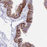 NALP12 Antibody in Immunohistochemistry (Paraffin) (IHC (P))