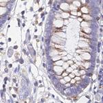 SPNS1 Antibody in Immunohistochemistry (IHC)