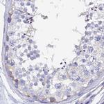 SPNS1 Antibody in Immunohistochemistry (IHC)