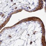 SPNS1 Antibody in Immunohistochemistry (IHC)