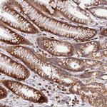 TCP-1 zeta Antibody in Immunohistochemistry (Paraffin) (IHC (P))