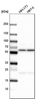 TCP-1 zeta Antibody in Western Blot (WB)