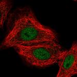 CLCN7 Antibody in Immunocytochemistry (ICC/IF)