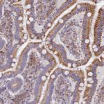 CLCN7 Antibody in Immunohistochemistry (Paraffin) (IHC (P))