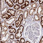 CLCN7 Antibody in Immunohistochemistry (Paraffin) (IHC (P))