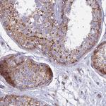 CLCN7 Antibody in Immunohistochemistry (Paraffin) (IHC (P))