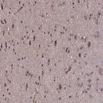 TIMM44 Antibody in Immunohistochemistry (Paraffin) (IHC (P))