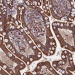 TIMM44 Antibody in Immunohistochemistry (Paraffin) (IHC (P))