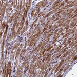 TIMM44 Antibody in Immunohistochemistry (Paraffin) (IHC (P))