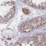 TIMM44 Antibody in Immunohistochemistry (Paraffin) (IHC (P))