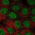 NSMCE1 Antibody in Immunocytochemistry (ICC/IF)