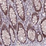 NSMCE1 Antibody in Immunohistochemistry (Paraffin) (IHC (P))