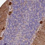 MFSD2A Antibody in Immunohistochemistry (Paraffin) (IHC (P))