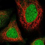 WDR41 Antibody in Immunocytochemistry (ICC/IF)