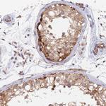 WDR41 Antibody in Immunohistochemistry (IHC)