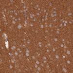 WDR41 Antibody in Immunohistochemistry (IHC)