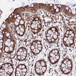 WDR41 Antibody in Immunohistochemistry (IHC)