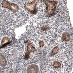 IRX1 Antibody in Immunohistochemistry (Paraffin) (IHC (P))