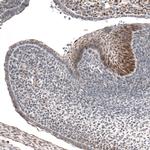 IRX1 Antibody in Immunohistochemistry (Paraffin) (IHC (P))