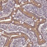 C14orf1 Antibody in Immunohistochemistry (IHC)