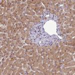 C14orf1 Antibody in Immunohistochemistry (IHC)