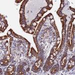 NDUFA5 Antibody in Immunohistochemistry (Paraffin) (IHC (P))